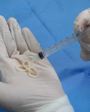 Matriz Ósea Desminelarizada
